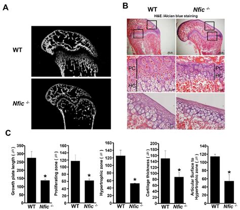 Altered Growth Plate Morphology In Nfic Mice A Representative