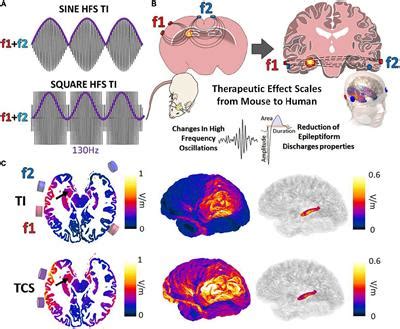 Frontiers Focal Non Invasive Deep Brain Stimulation With Temporal