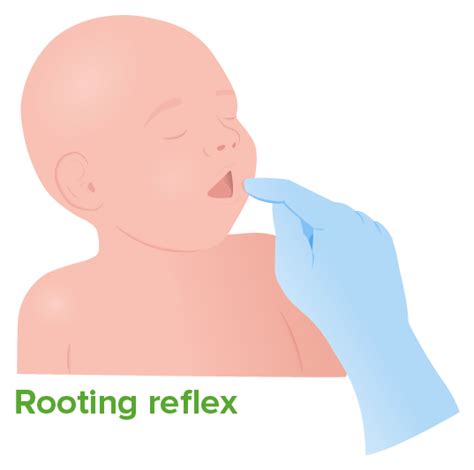 Physical Examination Of The Newborn Concise Medical Knowledge