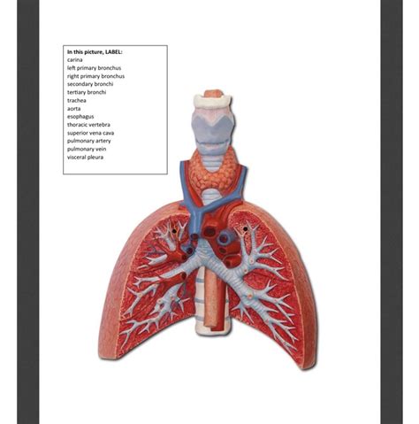 Solved In This Picture Label Carina Left Primary Bronchus