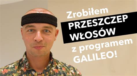 Przeszczep W Os W W Turcji Galileo Jerzy Mielewski Youtube