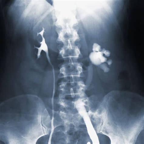 Radiografía de columna procedimiento y aplicaciones blog midiagnostico