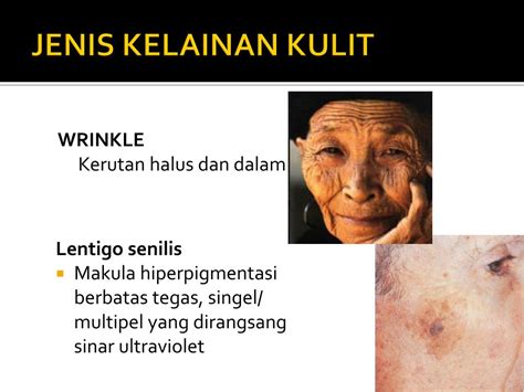 Ppt Skin Aging Powerpoint Presentation Free Download Id2159915