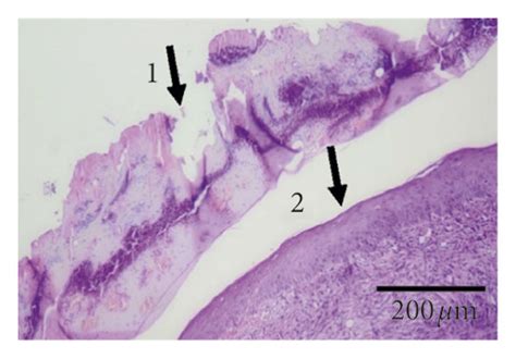 Inflammatory Infiltrate And Fibroblasts On The 9th Day After Lesion