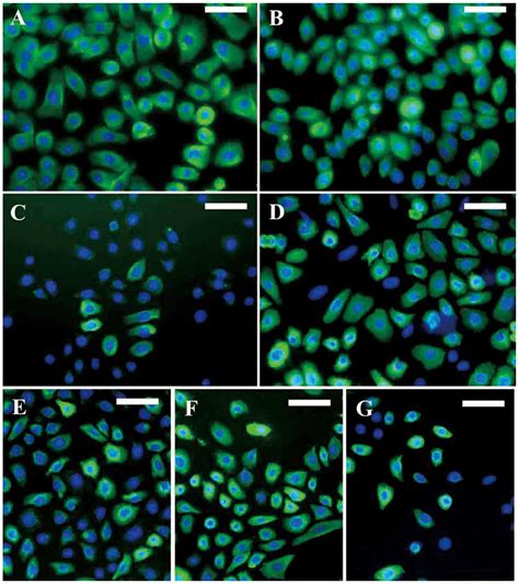 Isolation Culture And Phenotypic Characterization Of Human Sweat Gland