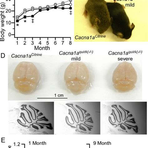 Conditional Knock Down Of P Q Type Channels In GCs And Precerebellar