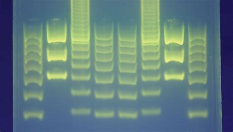 DNA Fingerprinting Definition Examples Facts Britannica