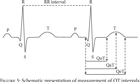 [PDF] Hypercalcemia-Induced ST-Segment Elevation Mimicking Acute ...