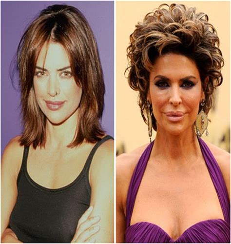 Lisa Rinna (Before & After) - Top 15 Celebs with Plastic Surgery