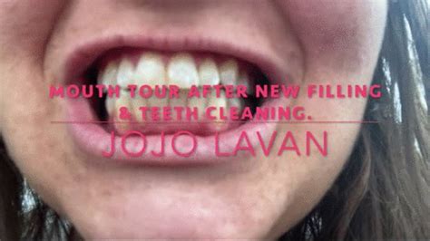 Mouth Tour Right After Dental Cleaning And New Filling Jojo Lavans