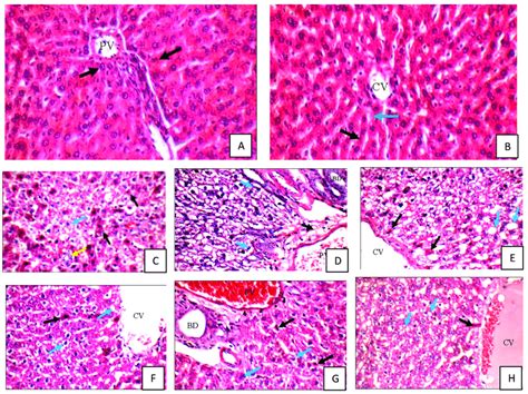 Histological Structure Of Rat Liver In Different Groups A Control