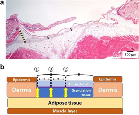 Measurement The Thickness Of The Granulation Tissue Layer The