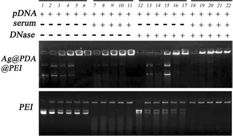 Gel Electrophoresis Results Of DNA Condensation And Protection Ability