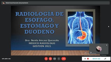 Radiologia De Esofago Estomago Y Duodeno Youtube