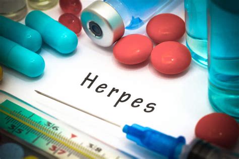 Oral Herpes: Symptoms and Treatment - Step To Health