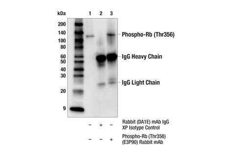 Phospho Rb Thr E P O Rabbit Mab Cell Signaling Technology