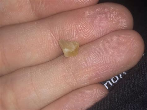 This Just Fell Out Of My Nose Nudes Popping NUDE PICS ORG