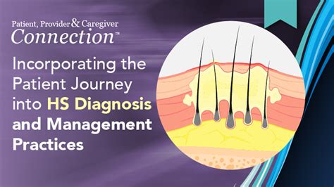 Hidradenitis Suppurativa Hs Optimizing The Management Approach With