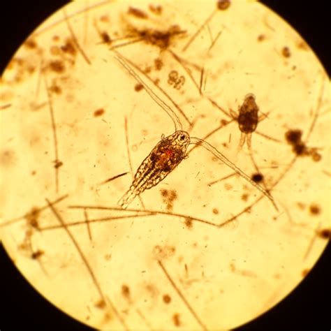 Plankton Identification and Enumeration | Northeast Aquatic Research, LLC