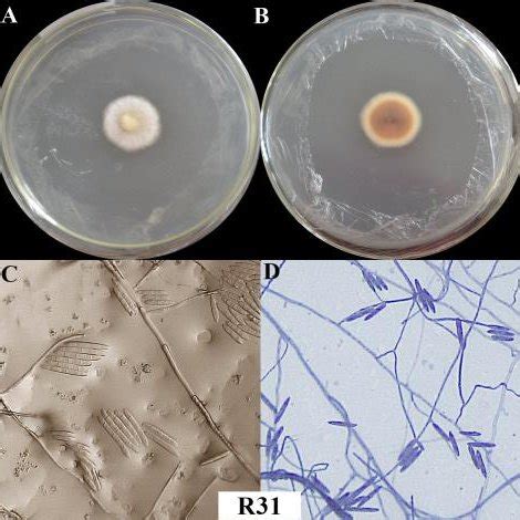 Morphology Of Endophytic Fungi Isolated From Syzygium Aqueum Leaves