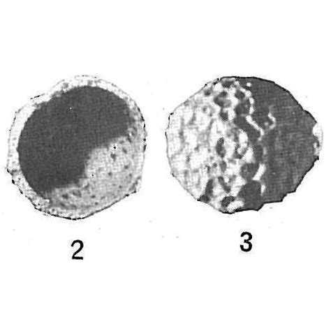 Thurammina Favosa Unknown None Recent Holocene Quaternary Foraminifera