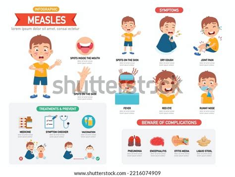 Infograf A De Sarampi N Con Ni Os Personajes Vector De Stock Libre De