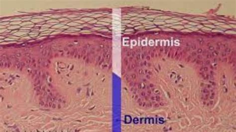 7 Fungsi Epidermis Di Kulit Bagian Penting Dan Cara Merawatnya