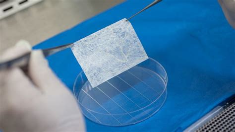 Künstliche Vagina aus dem Labor DER SPIEGEL