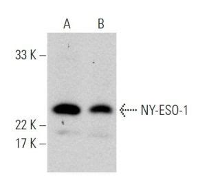 NY ESO 1 Antibody E978 Western Blotting Image 364985