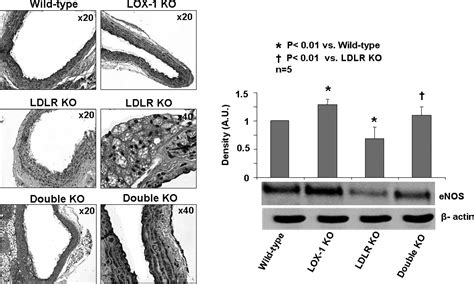 Deletion Of LOX 1 Reduces Atherogenesis In LDLR Knockout Mice Fed High