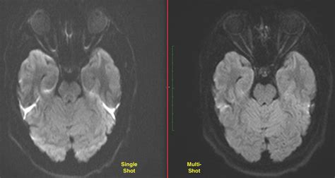 Magnetism Questions And Answers In Mri