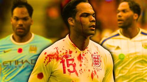 What happened to Joleon Lescott's head? From football pitches to expert ...