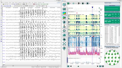 Electroencefal Grafo Bwiii Eeg Plus