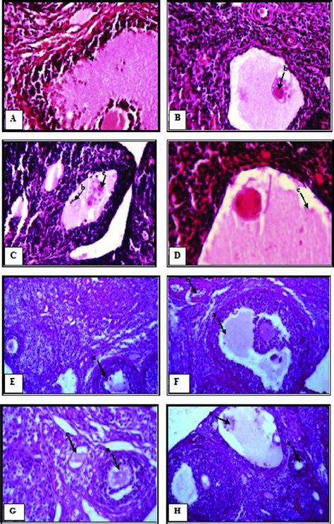 Histological Sections Of The Ovary Of Controls And Treated Rats With