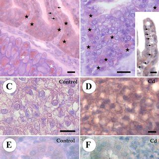 Light Micrographs Showing Immunolocalisation Of Metallothioneins In