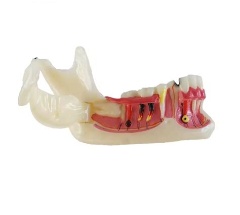 Model Of Right Lower Posterior Teeth Niche Healthcare