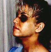 Karla Homolka Crime Scene Photos