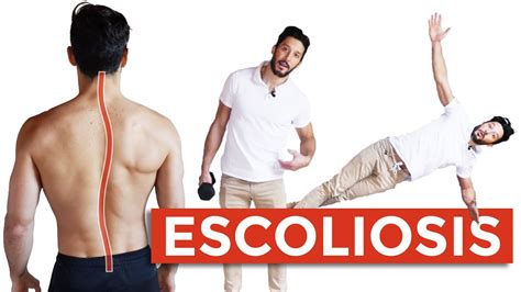 5 Ejercicios para la ESCOLIOSIS Cuando Es Grave y Qué Hacer YouTube