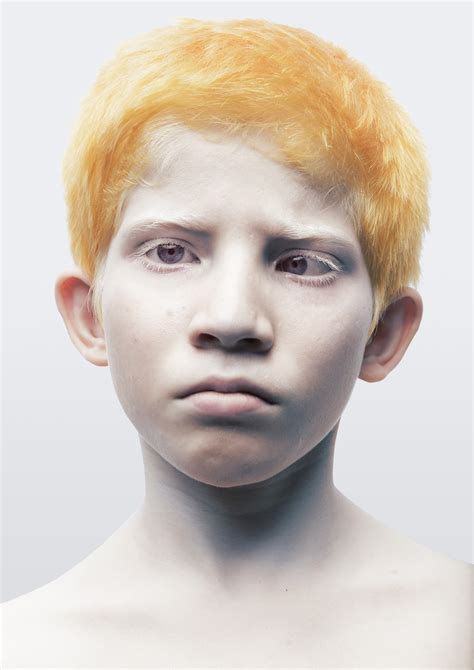 Indian Boys with Albinism — Brent Stirton