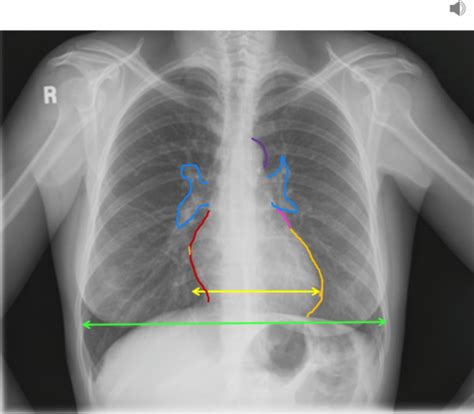 Cardiology Anatomy And Physiology Primer Flashcards Quizlet