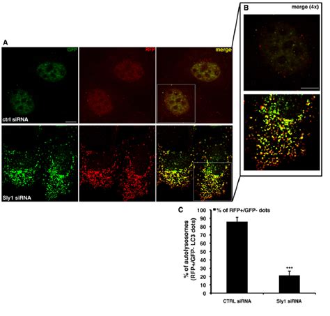 Knockdown Of Sly Impairs Autophagic Flux A B Hela Cells Stably