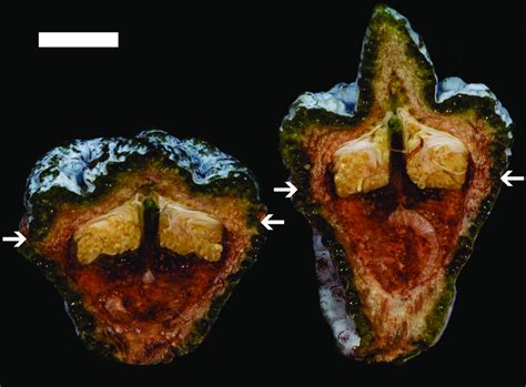 Longitudinal Sections Of Phenotypically Distinctive Flower Buds Of