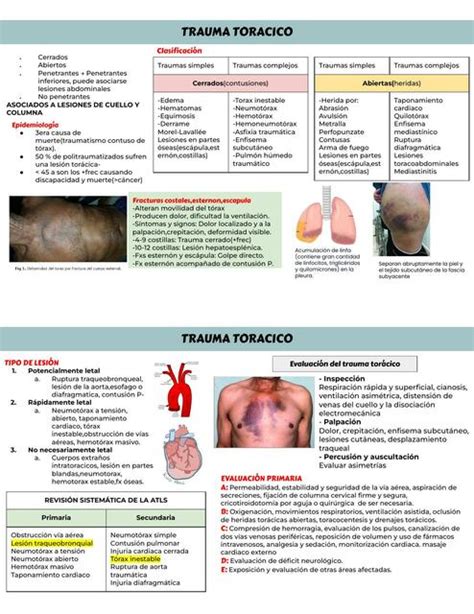 Trauma TorÁcico Aaron Yarleque Udocz