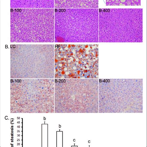 Baicalin Attenuates High Fat Diet Induced Liver Steatosis A