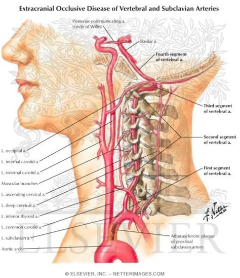 Spine And Back Arteries Vertebral Artery Ranzcrpart1 Wiki Fandom