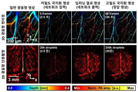 인공지능 광음향기술로 고속·고해상도 혈관 영상 찍는다 韓‧美연구팀 딥러닝 기반 고속 국지화영상기법 개발