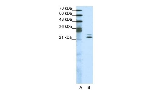 BUD31 Antibody Cat No 28 861 ProSci