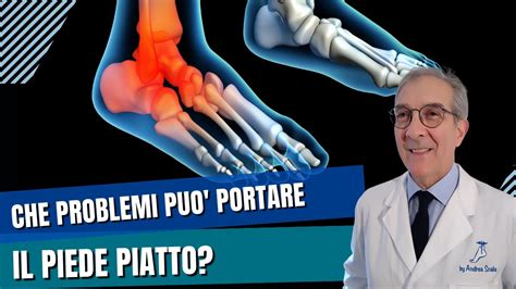 Che problemi può portare il piede piatto Piede piatto pronato