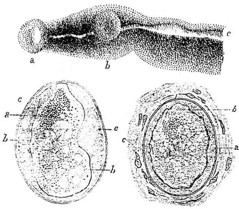 Schistosoma Japonicum Parasites And Eggs Sketches By Katsurada Dr 1904