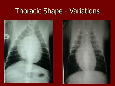 Ppt Normal Radiographic Anatomy Of The Thorax Powerpoint Presentation